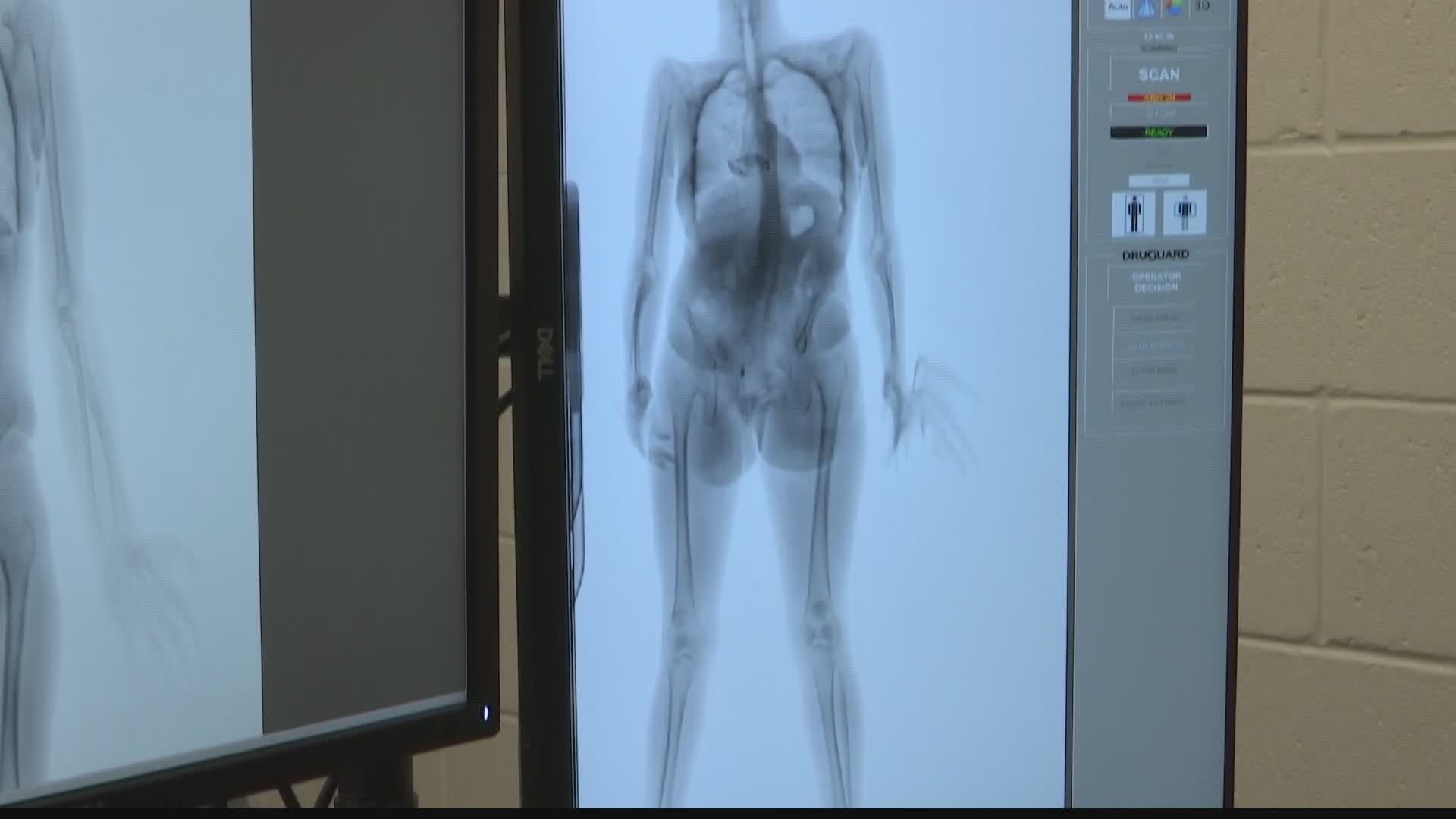 Instead of strip-searching, workers can analyze a body scan to check for any items being hidden on inmates.