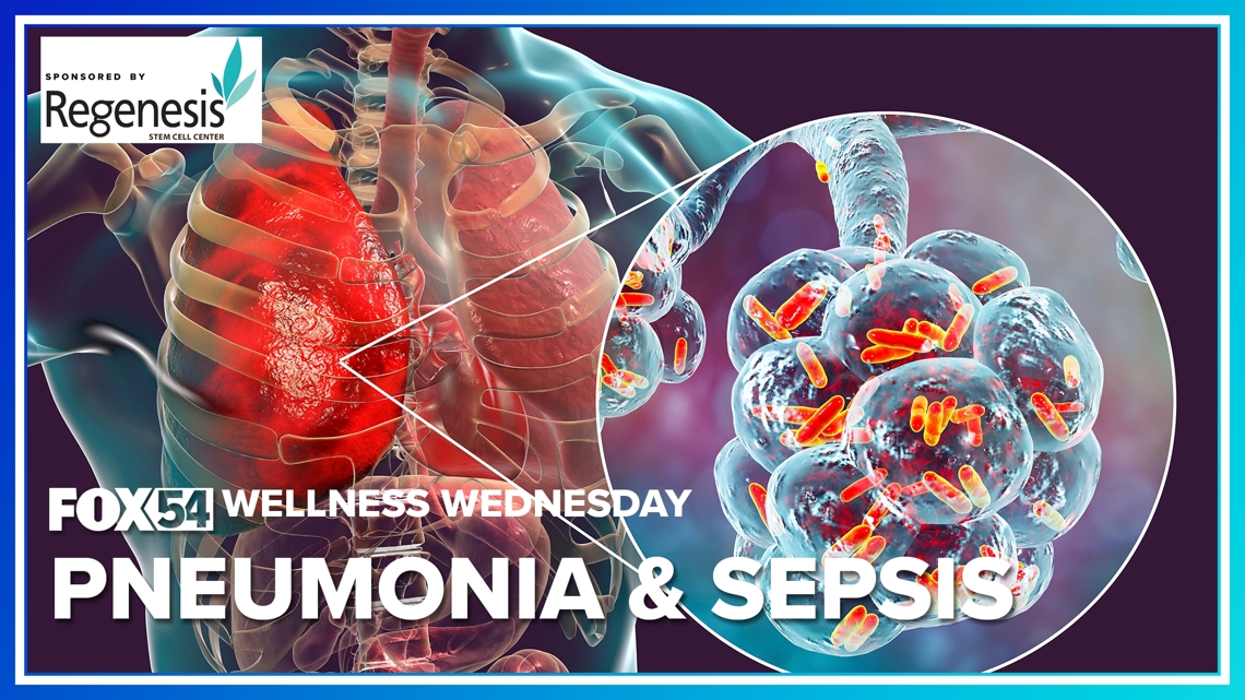 Wellness Wednesday: Understanding pneumonia & sepsis