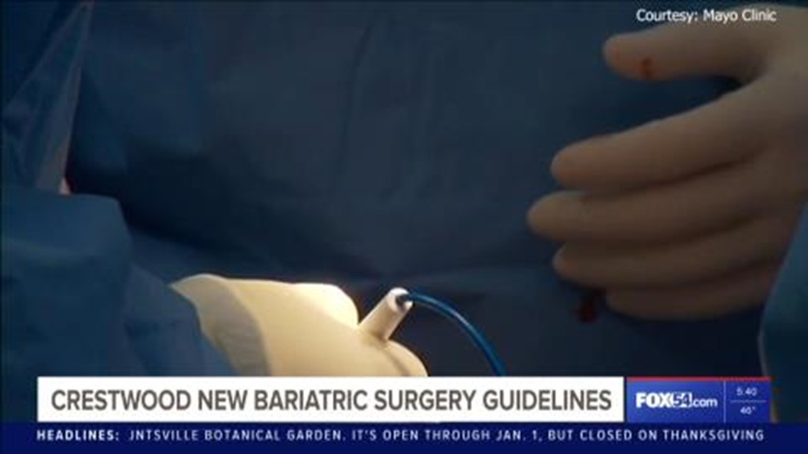Guidelines for bariatric surgery updated