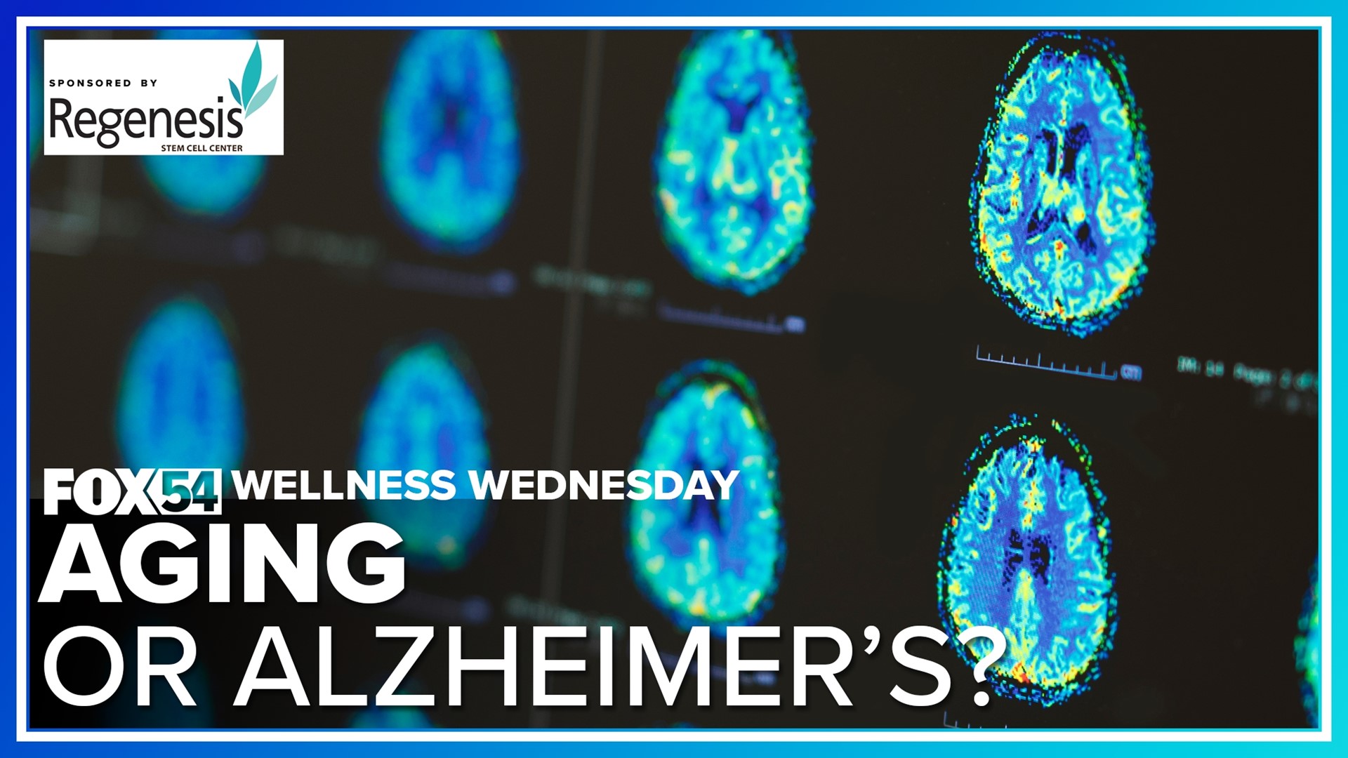 Wellness Wednesday | Alzheimer's or Aging? What you need to know.