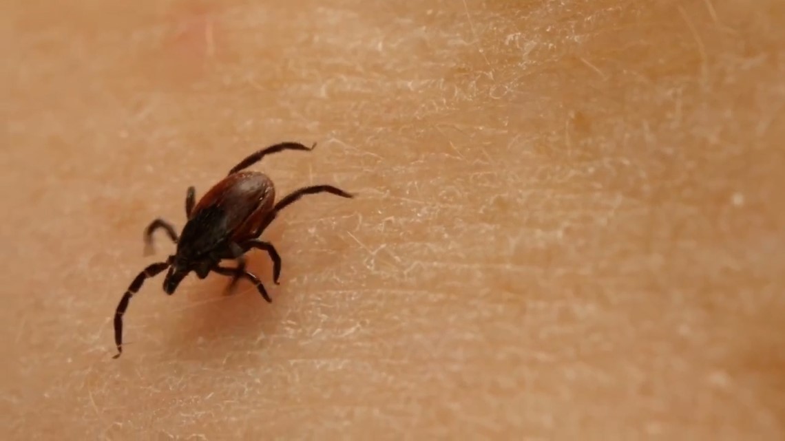 Tick season, Lyme disease, Rocky Mountain spotted fever are here ...