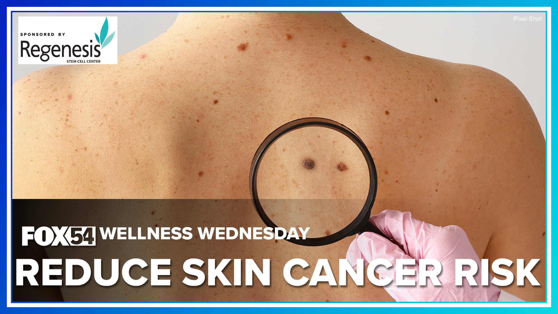 Wellness Wednesday | Reduce skin cancer risk | rocketcitynow.com