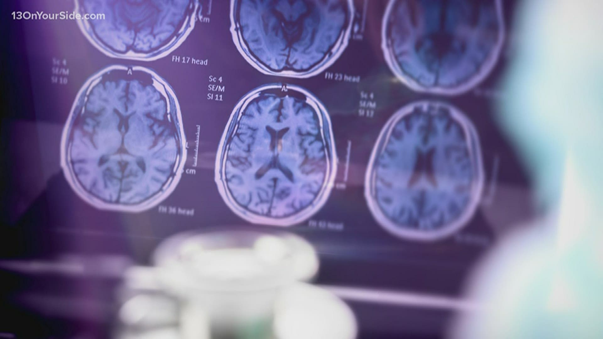 Local hospitals see uptick in strokes due to COVID-19.